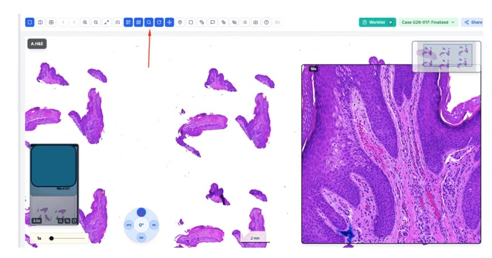 Adjustable Magnification Lens