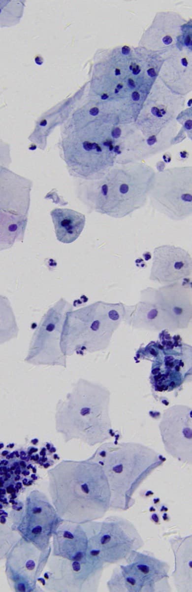 Liquid-based cytology showing clear cellular morphology under brightfield imaging.