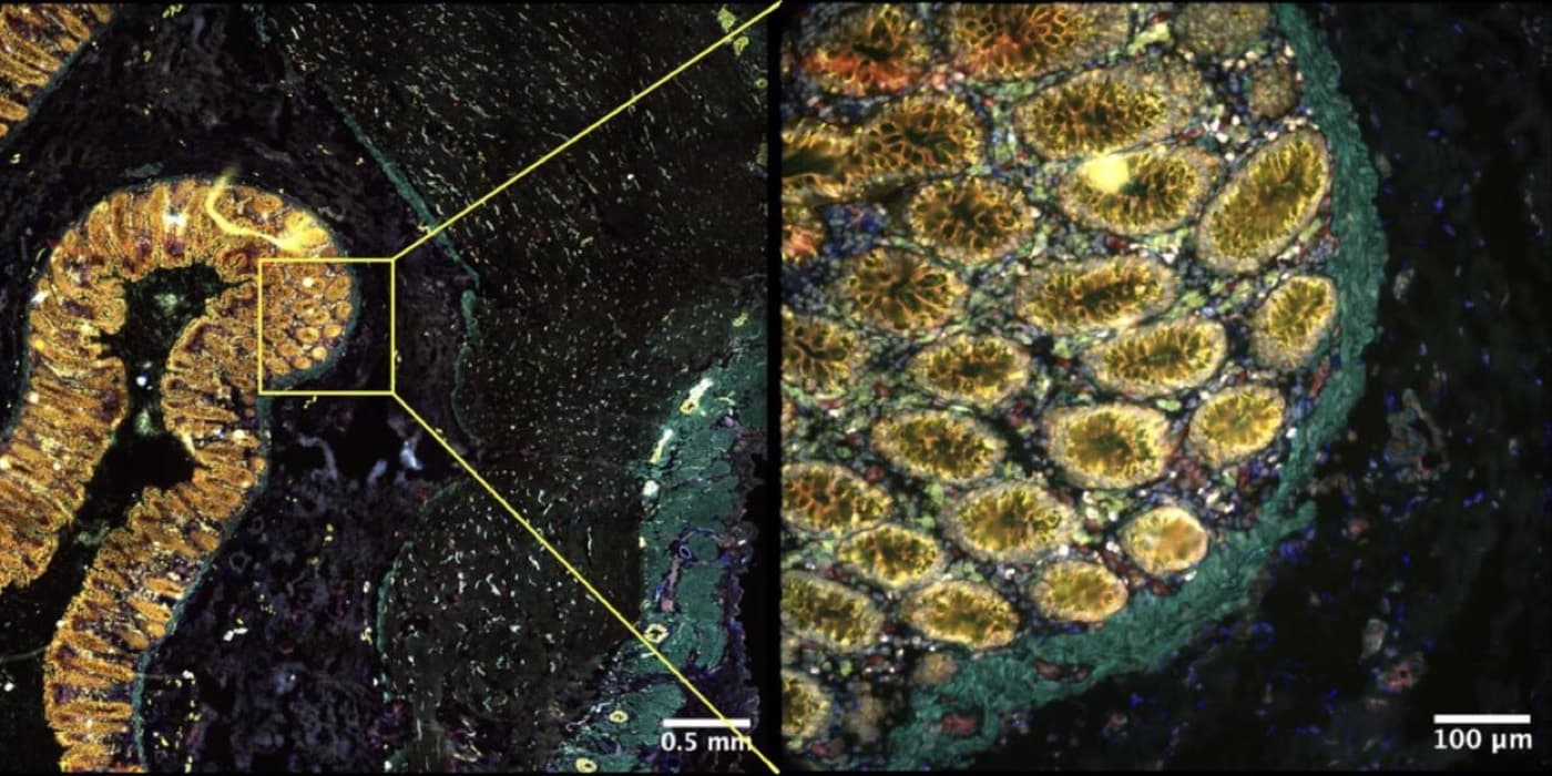 Multiplex immunofluorescence with seamless stitching — whole-section overview alongside high-power detail.