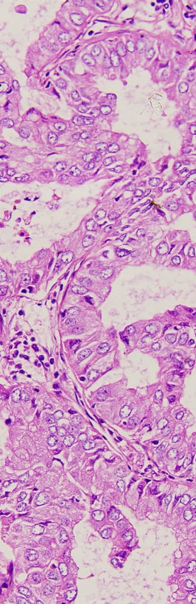 Brightfield H&E histology captured at 20× with crisp nuclear and cytoplasmic detail.